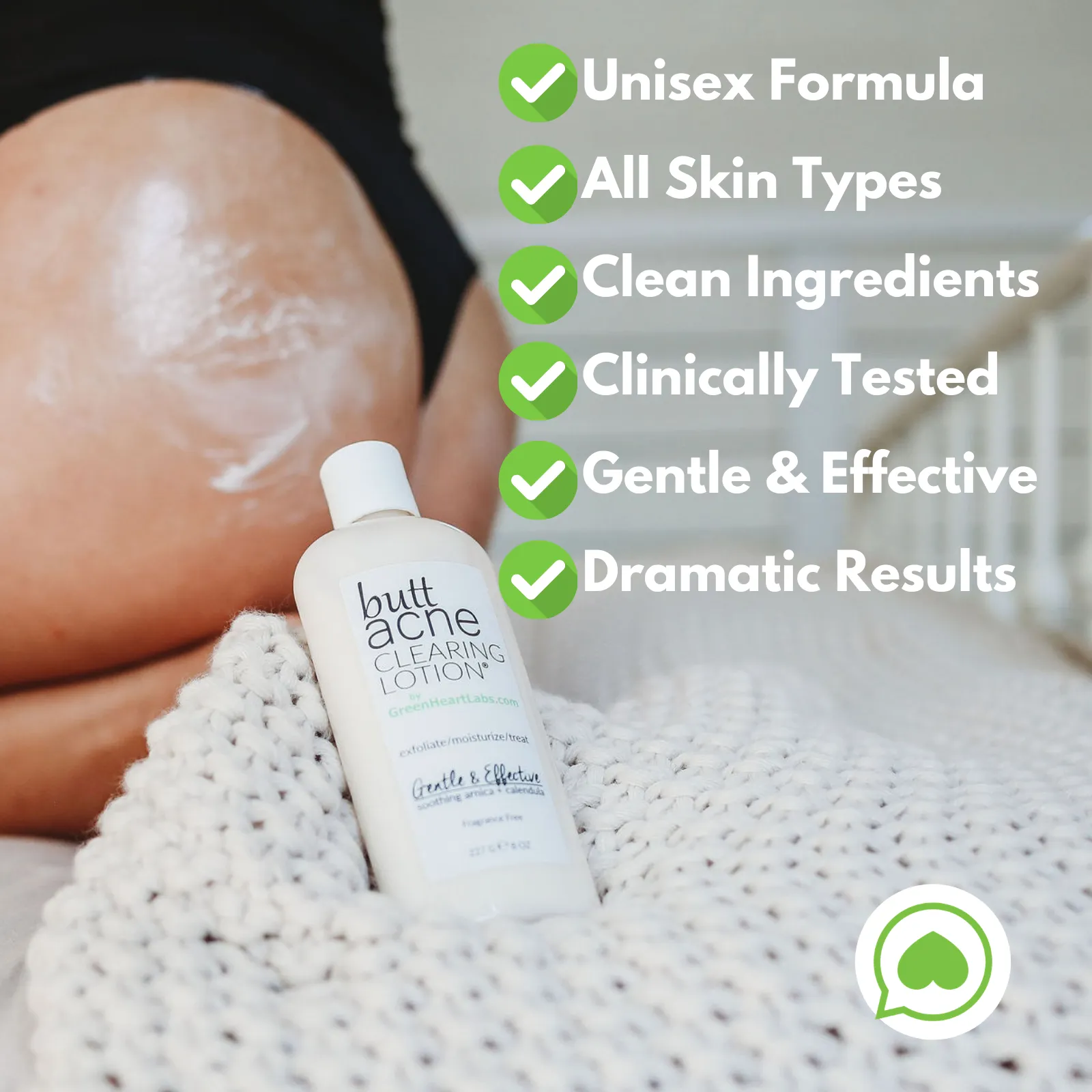 Butt Acne Clearing Lotion ® | 4 oz (113 gr)